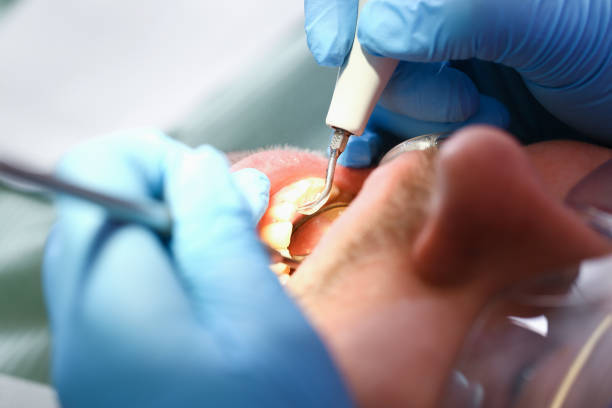 Best Same-Day Emergency Dentist in Alvord, TX