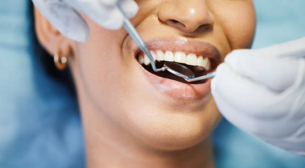 Best Walk-In Emergency Dentist in Alvord, TX