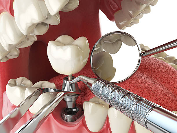 Best After-Hours Emergency Dentist in Alvord, TX